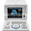 Cheapest Digital Portable Ultrasound Scanner RUS-6000D