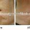 Vacuum cavitation rf body slimming machine for home use