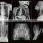 MY-D049J-D hospital equipment medical floating table digital x-ray radiography system dr xray machine prices