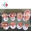 HC-S344 Medical teaching vivid advanced Human embryo development process model for sale