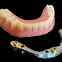 China Screw Implant Crown And Cridge Manufacturers Factory Suppliers