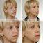 BIO-1005 BIO машина для красоты