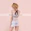 Hot Lace Transparent Women Fashion New Arrival Sexy Lace Dresses