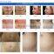 rf microneedling machine microneedle rf machine fractional rf microneedle machine