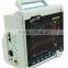Veterinary Patient Monitor for Vet Pet animal use Built-in rechargeable battery with thermal printer low price