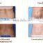 Vacuum cryotherapy fat freezing for fat reducing body Slimming Machine for beauty salon