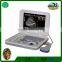 medical laptop sleek ultrasound scan machine cheapest ultrasound for vet