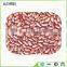 hot sale and best quality light speckle kidney beans