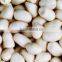 peanut kernels,blanched peanut ,peanut in shell,roasted peanut kernels,roasted peanut chopped and splits,roasted peanut inshell