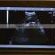 Best-selling Laptop Ultrasound Scanner/Ultrasound machine with 3.5Mhz multi-frequency convex probe RUS-9000F