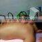 Cupping suction for breast enlarge breast lift machine
