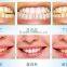 offer OEM and ODM service whitening teeth strips