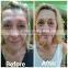 Multifunction SHR+Elight+IPL opt ipl  hair removal machine Hair Removal dark circle wrinkle remove tattoo OPT Beauty machine