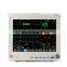 Multi-parameters Portable Veterinary Vet Vital Sign Monitor
