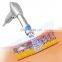 OSANO shockwave therapy shock wave