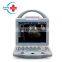 HC-A012A Hot Sale Full digital portable Doppler Color Ultrasound scanner