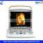 CE FAD 4d Ultrasound Machine