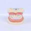 Dental lab Teeth Education model plastic denture dental clinic model products wholesale