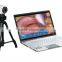 new design Digital Electronic Colposcope with clear image