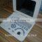 Laptop Ultrasound Scanner & Ultrasound Scanner For Horse