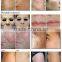 RF Pipe Fractional Co2 Carboxytherapy Laser Vaginal Tightening Machine Treat Telangiectasis