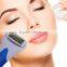 High quality Face care derma roller with ICE derma roller