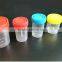 Ganda high quality sterile specimen container for urine 60ml