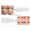 Thermagic FLX tips Skin Rejuvenation Machine Facial Anti Aging RF Beauty Instrument  Body Lifting treatment head