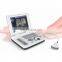 Laptop 10.4inch Elements Medical Ultrasound Machine for Vet Pregnancy