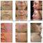 Home Use Portable Fractional RF Micro Needle Wrinkle Removal/ Facial Skin Tightening Fractional RF