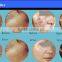 Acne Scar Removal Factory Price!! Gynecology Professional Fractional Co2 100um-2000um 15W(20W) Laser Machine / Fractional Co2 Laser Vaginal Tightening Face Whitening