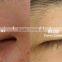 Skin Analysis System A-one With Pre-set Well Skin Analysis Software