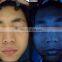High quality professional 3D auto-focus Magic mirror system face analyzer skin analyzer machine with printer
