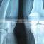 China KND-A/F CE medical dry film agfa healthcare