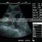 Sonostar 3D Built-in Battery Portable Vascular Cheapest Ultrasound Machine