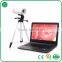 gynaecology diagnostic equipment/vagina examination/video colposcope manufacturer in China