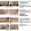 DEESS 1050000 shots 3 in 1 no side effect ipl laser machine