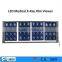 medical LED adjustable film viewer / x ray machine/ negatoscope