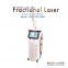 Co2  fractional laser for removing scar and pigment