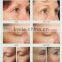 AYJ-C19(CE) Dot matrix portable rf thermagic galvanic facial machine