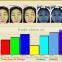 portable dialysis machine/facial skin analyzer machine skin scan/skin analyser for face