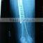 hot selling Konida dental fuji dry film agfa laser x-ray film