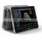 best Touch Screen Tablet Ultrasound machine from manufacturer