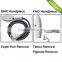 Good Quality 2 in 1 SHR and ND YAG laser machine Movable Screen Bikini Hair Removal 10HZ