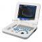 2016 New design! Full digital medical portable notebook laptop ultrasound machine/system with low price-Shelly