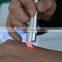 2016 Newest Korea Machine 980nm Diode Laser Removal Vascular Clearance Machine for Spider Removal Veins Removal for Skin Clinic