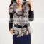 genuine rabbit fur knit vest with fox fur collar/#00V25