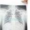 Digital x-ray film