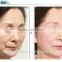 professional Clinic high intensity focused ultrasound Face Lift For wrinkle removal System