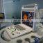 Good quality 15 inch LED full digital  Portable  color doppler ultrasound scanner